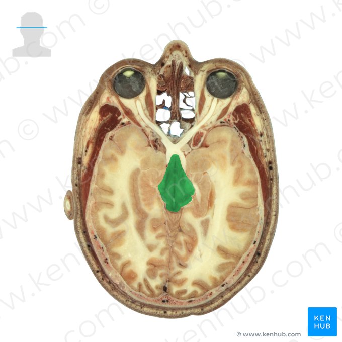 Mesencephalon (Mittelhirn); Bild: National Library of Medicine