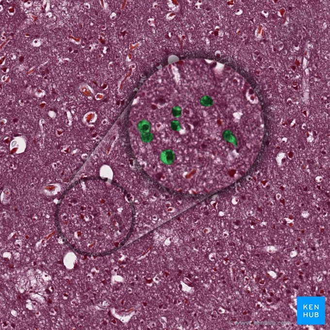 Neurons (Neura); Image: 