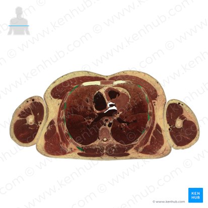 Músculos intercostales internos (Musculi intercostales interni); Imagen: National Library of Medicine