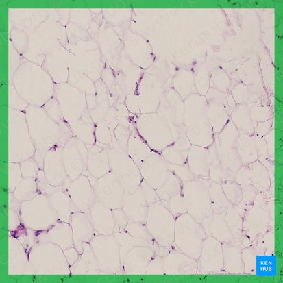 Adipose tissue (Textus adiposus); Image: 