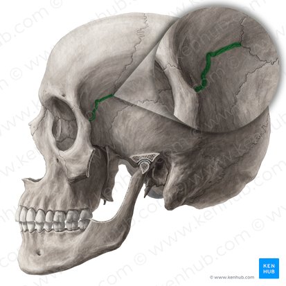 Sphenofrontal suture (Sutura sphenofrontalis); Image: Yousun Koh