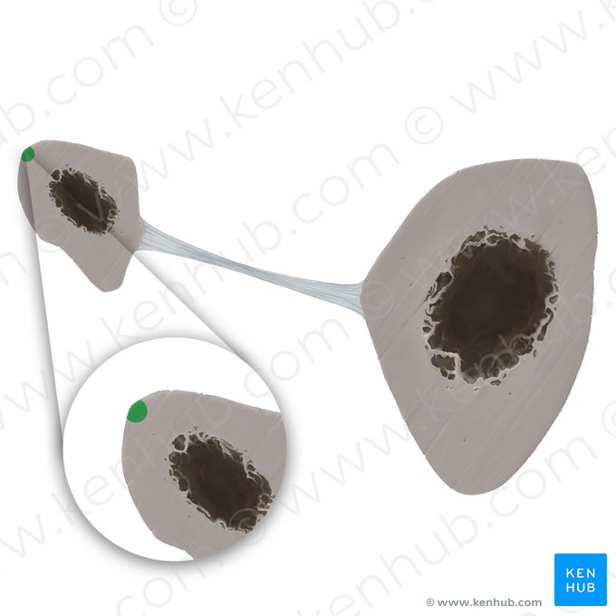 Margo posterior fibulae (Hinterrand des Wadenbeins); Bild: Tal Bavli Ziv