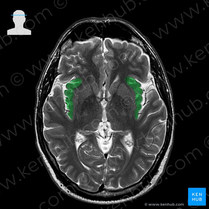 Insula; Image: 