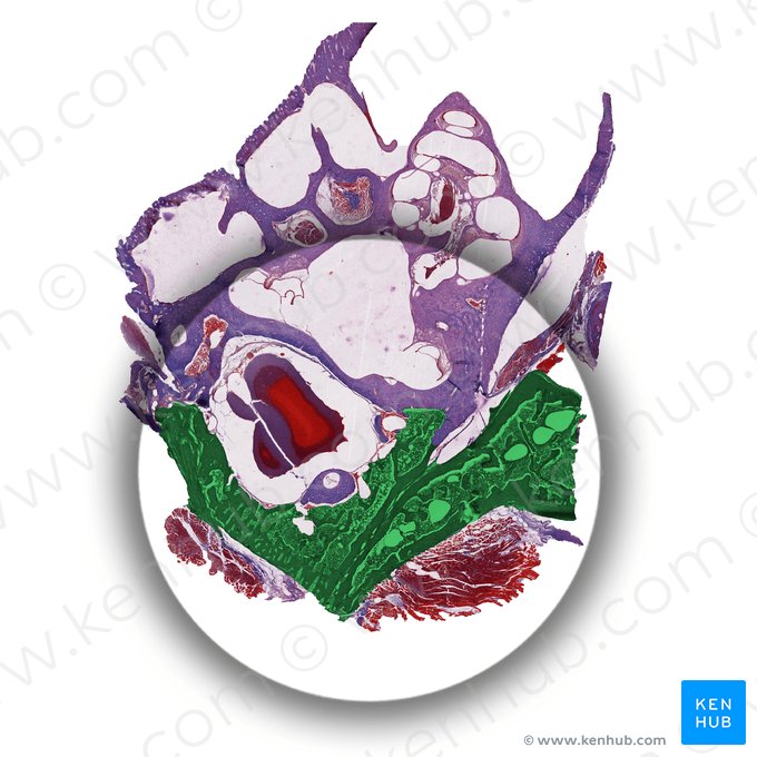 Cellulae mastoideae (Mastoidzellen); Bild: 