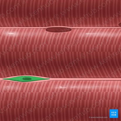 Fibroblast (Fibroblastus); Image: Tal Bavli Ziv