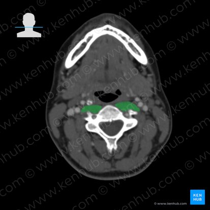 Longus capitis muscle (Musculus longus capitis); Image: 