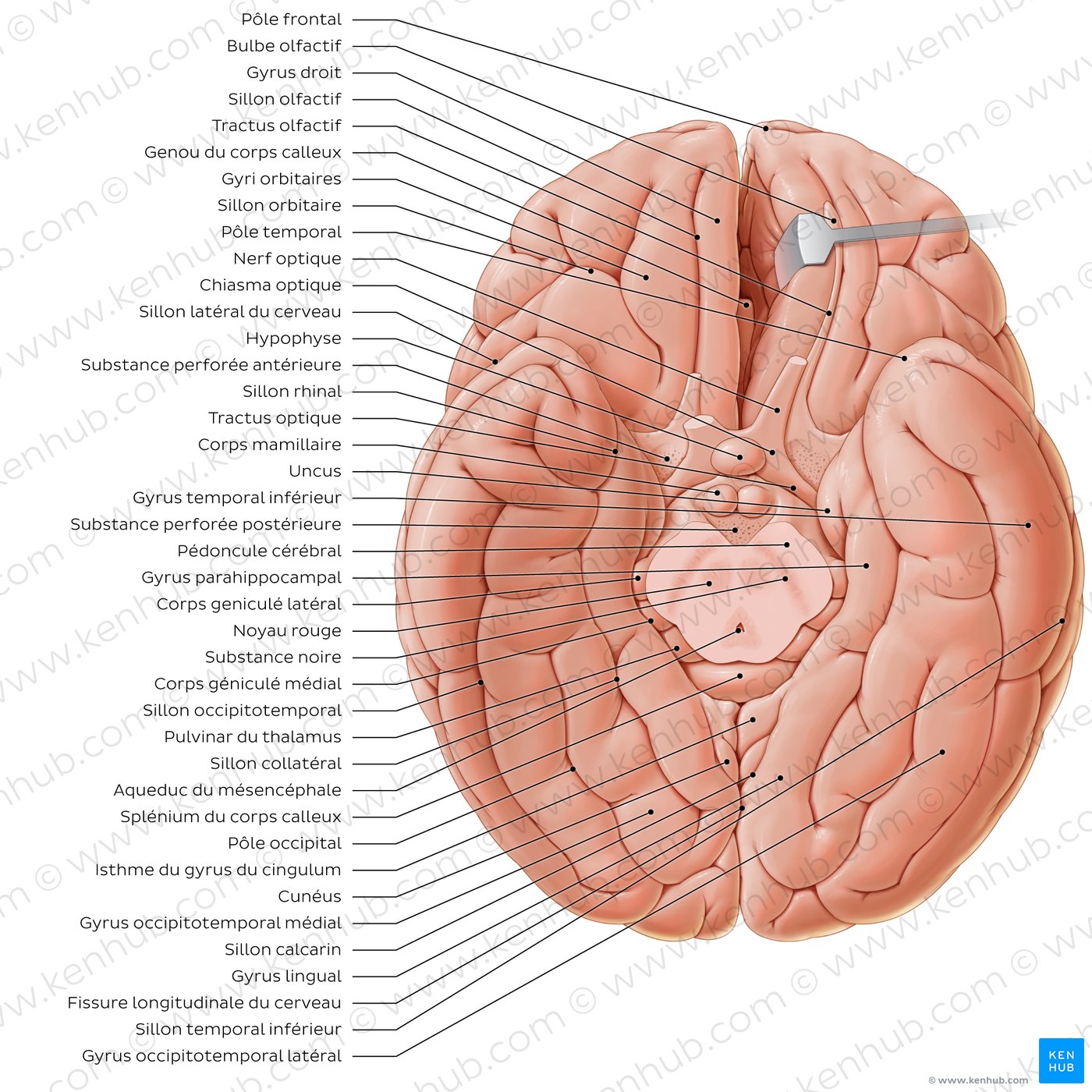 Basal view of the brain