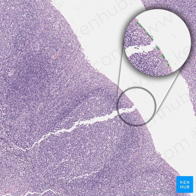 Epithelial cells; Image: 