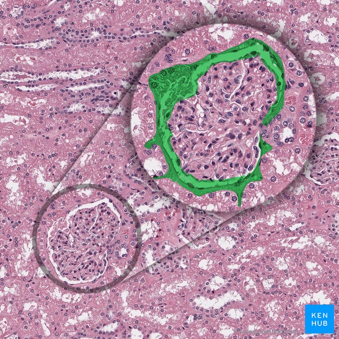 Glomerular capsule (Capsula glomerularis); Image: 