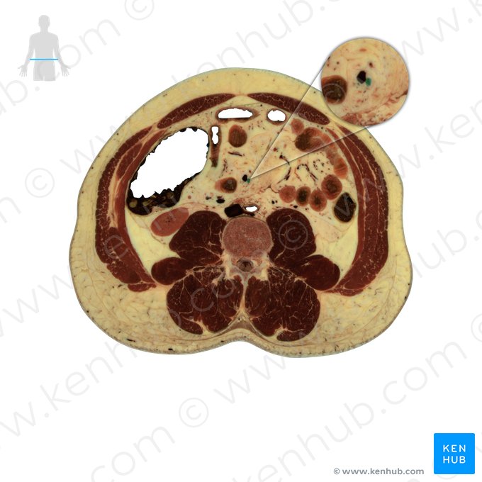 Superior mesenteric artery (Arteria mesenterica superior); Image: National Library of Medicine