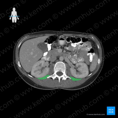 Musculus quadratus lumborum (Viereckiger Lendenmuskel); Bild: 