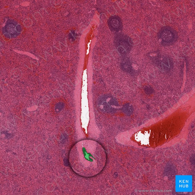 Arteria trabecularis splenis (Trabekelarterie der Milz); Bild: 