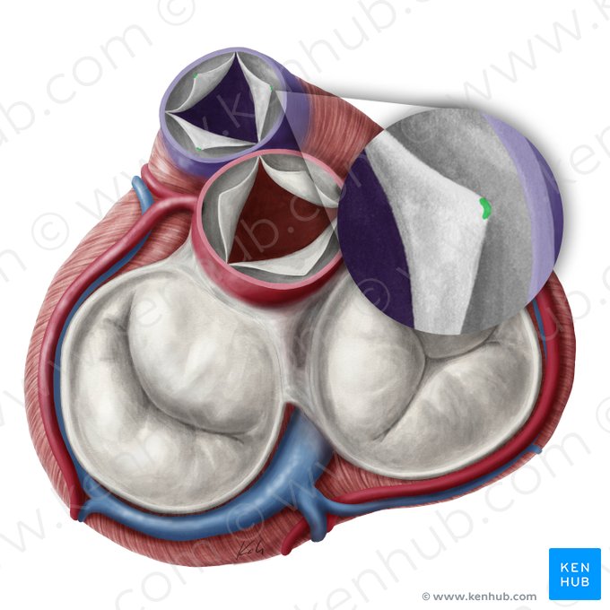 Nodules of semilunar leaflets of pulmonary valve (Noduli valvularum semilunarium valvae trunci pulmonalis); Image: Yousun Koh