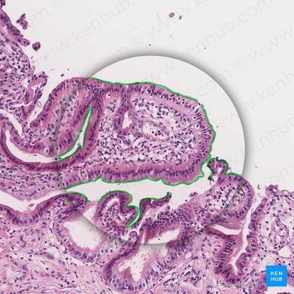 Microvilli; Image: 