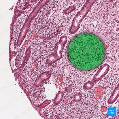 Endometrial stroma; Image: 