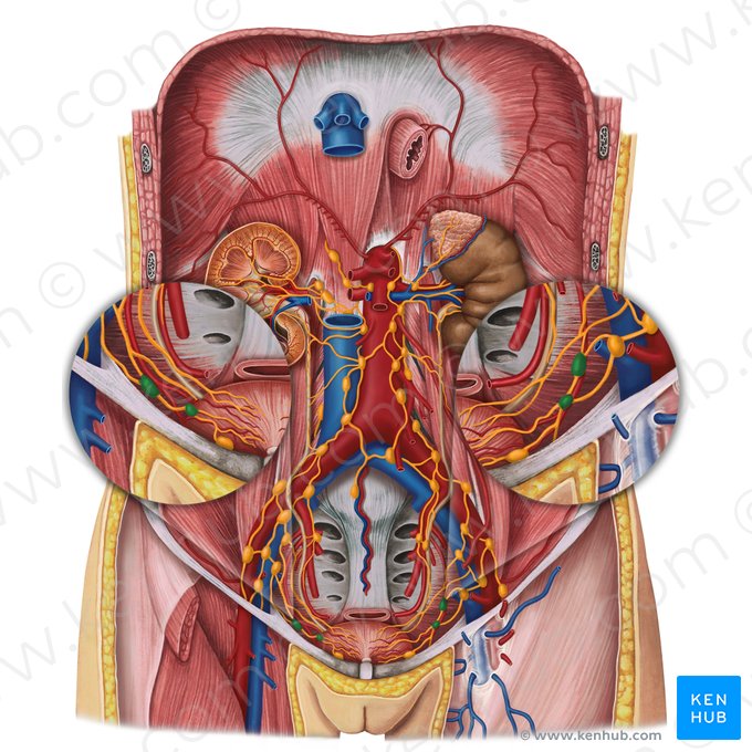 Nodi lymphoidei vesicales laterales (Seitliche Harnblasenlymphknoten); Bild: Irina Münstermann