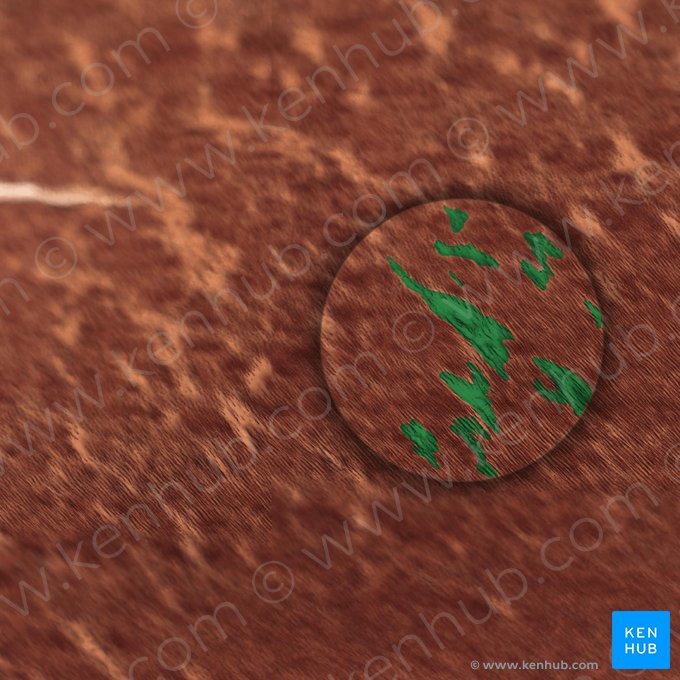 Interglobular dentin; Image: 