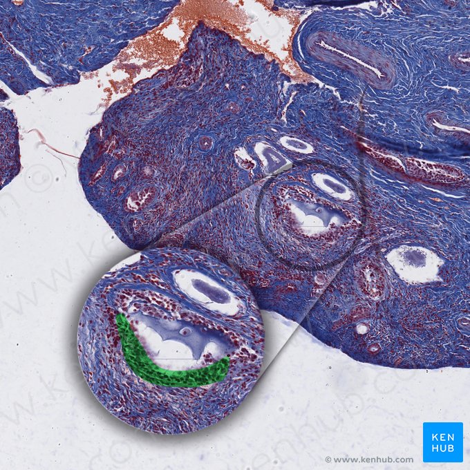 Membrana vitrea (Glaskörpermembran); Bild: 