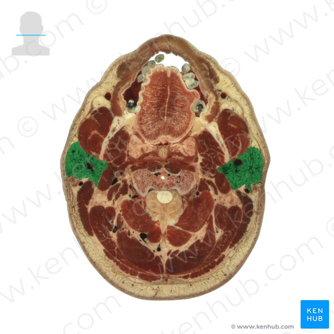 Parotid gland (Glandula parotidea); Image: National Library of Medicine