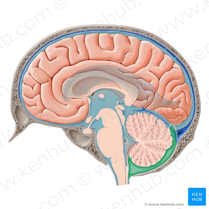 Cisterna cerebellomedullaris posterior (Hintere Kleinhirn-Rückenmark-Zisterne); Bild: Paul Kim