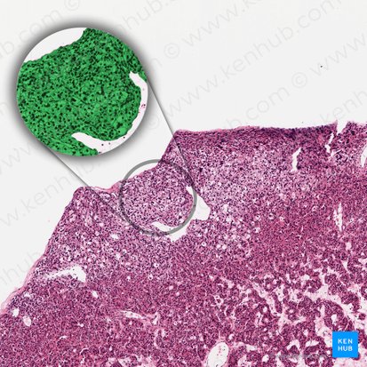 Parathyroid principal cell (Parathyrocytus endocrinus); Image: 