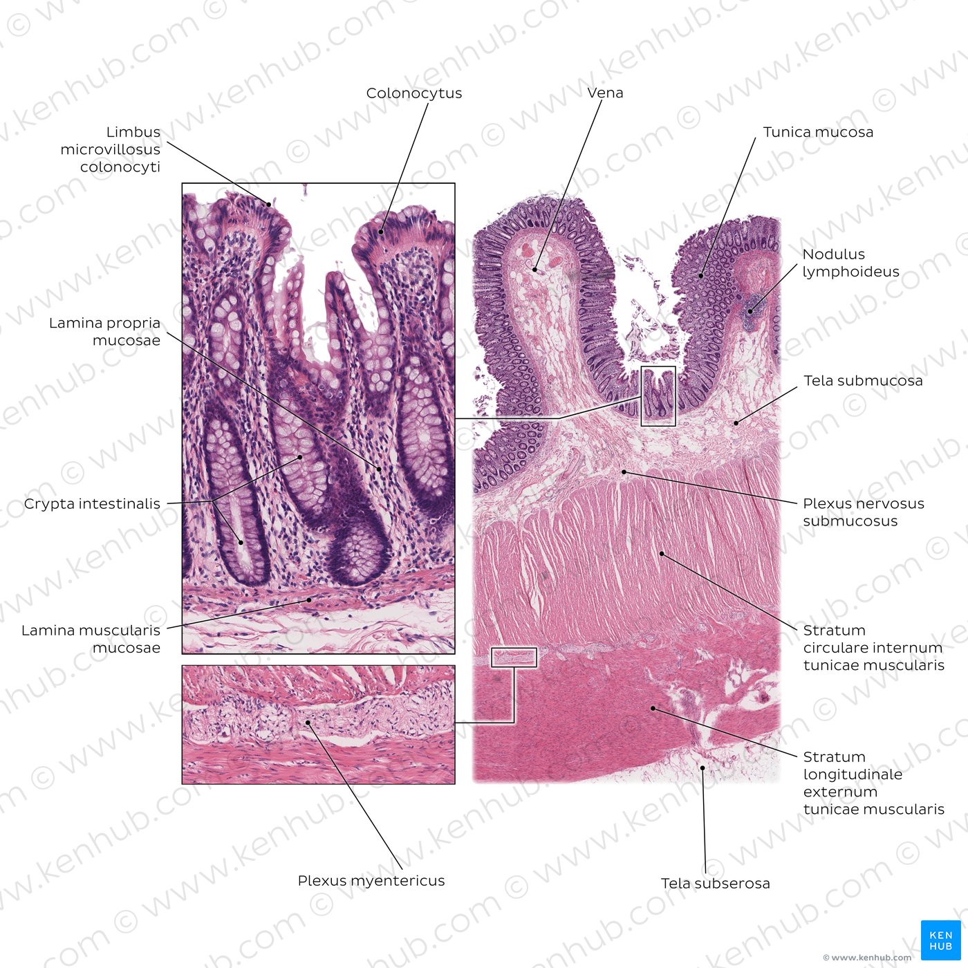 Colon (Färbung: Hämatoxylin-Eosin; links: niedrige Vergrößerung, rechts: hohe Vergrößerung)