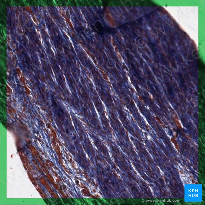 Dense regular collagenous connective tissue; Image: 