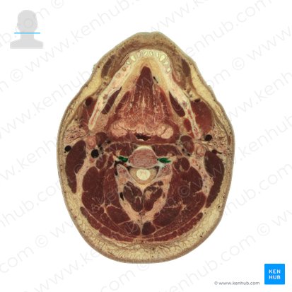 Longus colli muscle (Musculus longus colli); Image: National Library of Medicine