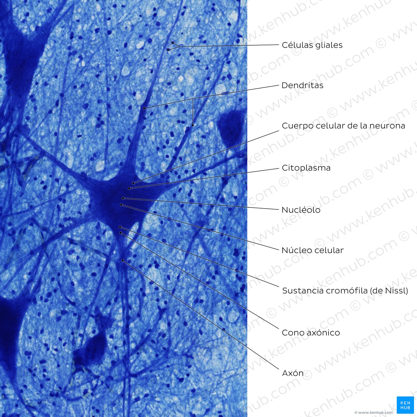 Neurona multipolar