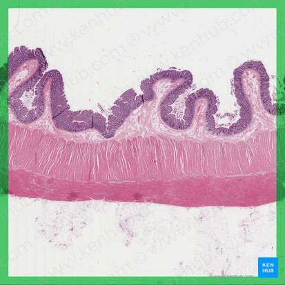 Colon (Grimmdarm); Bild: 
