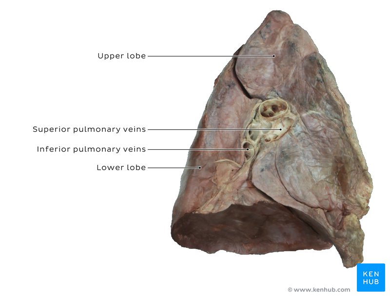 Left lung - medial view