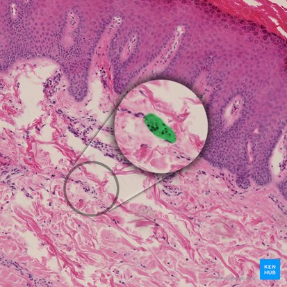 Bulbous (Ruffini) corpuscle (Corpusculum sensorium fusiforme); Image: 