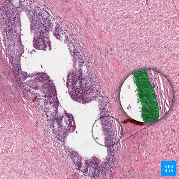 Epithelium pseudostratificatum columnare stereociliatum (Mehrreihiges hochprismatisches Epithel (mit Stereozilien)); Bild: 