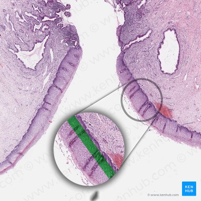 Parabasal cell layer of squamous epithelium; Image: 