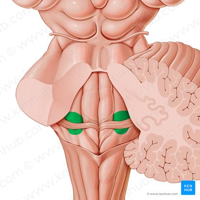 Area vestibularis ventriculi quarti (Area vestibularis des vierten Ventrikels); Bild: Paul Kim