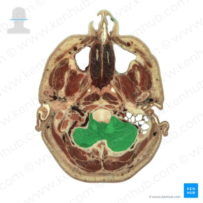 Cerebellum (Kleinhirn); Bild: National Library of Medicine