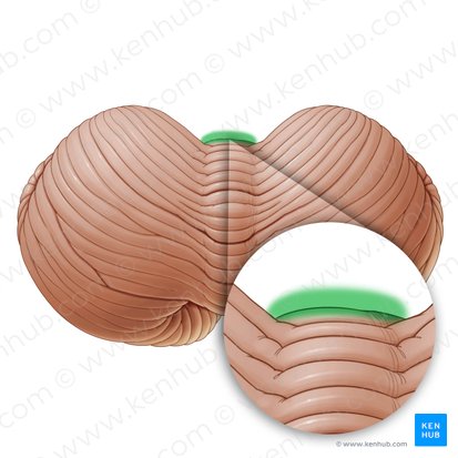 Incisura cerebelar anterior (Incisura anterior cerebelli); Imagem: Paul Kim