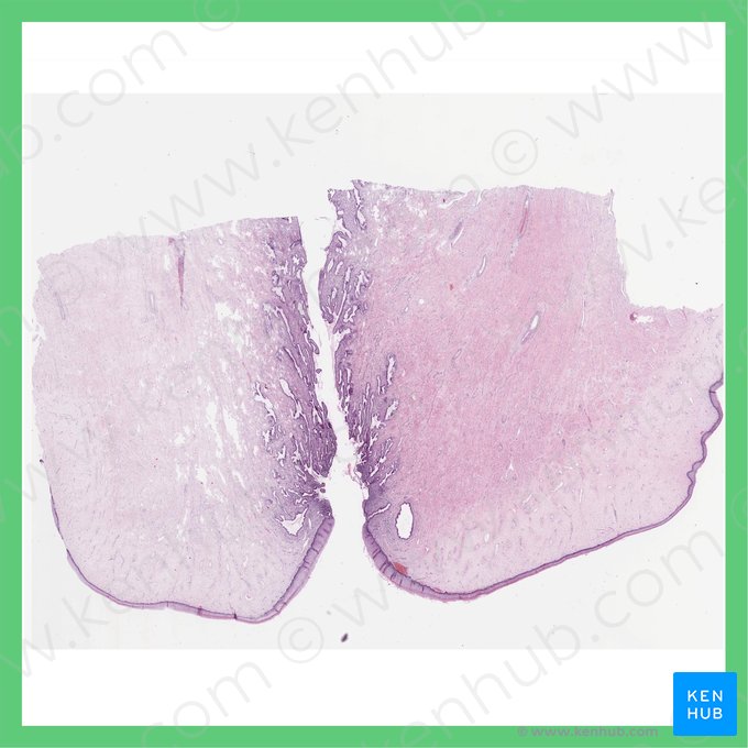 Cervix uteri (Hals der Gebärmutter); Bild: 