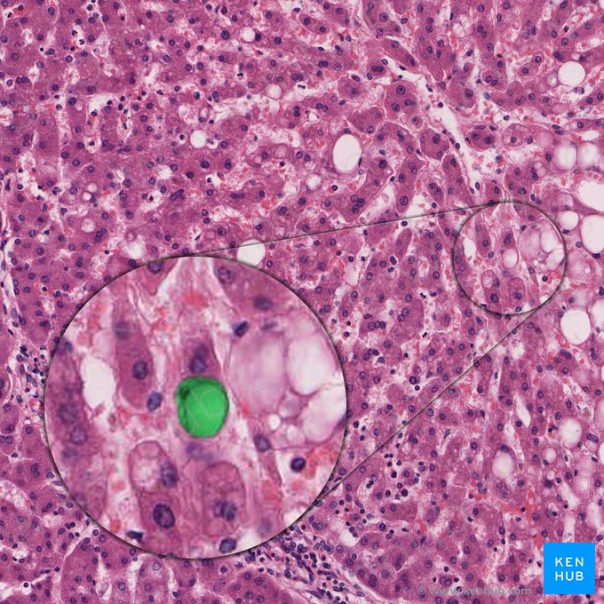 Hepatic stellate cell (Cellula perisinusoidalis); Image: 