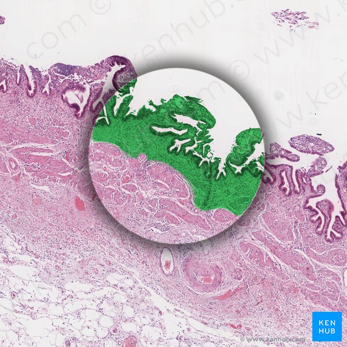 Tunica mucosa (Mukosa); Bild: 