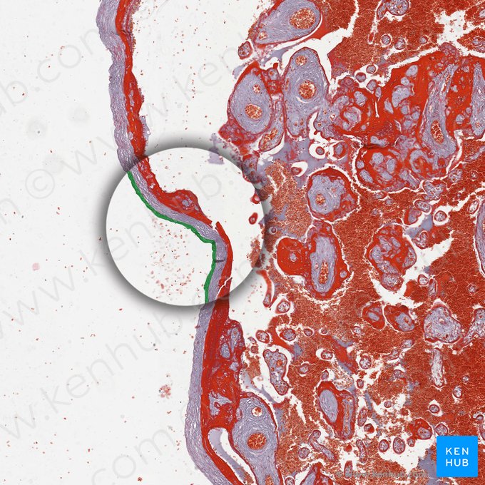 Amniotic surface; Image: 