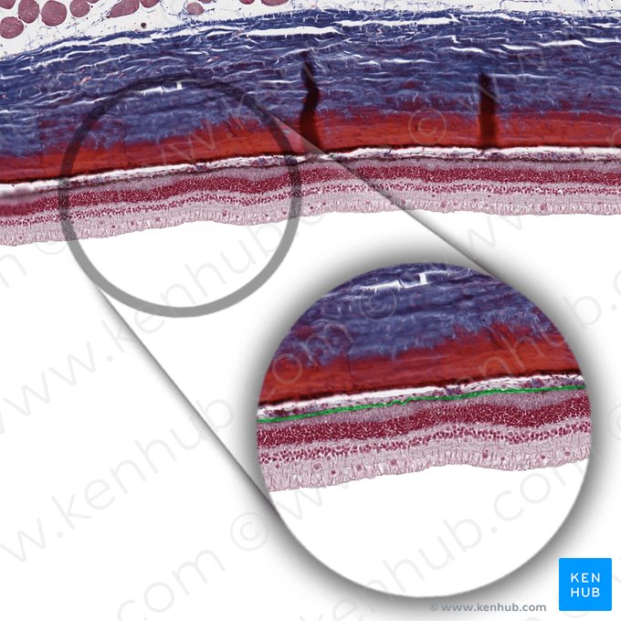 Pigmented layer of retina (Stratum pigmentosum retinae); Image: 