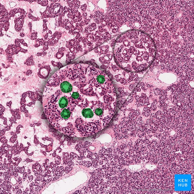 Pseudofolliculus parathyroideus (Pseudofollikel); Bild: 