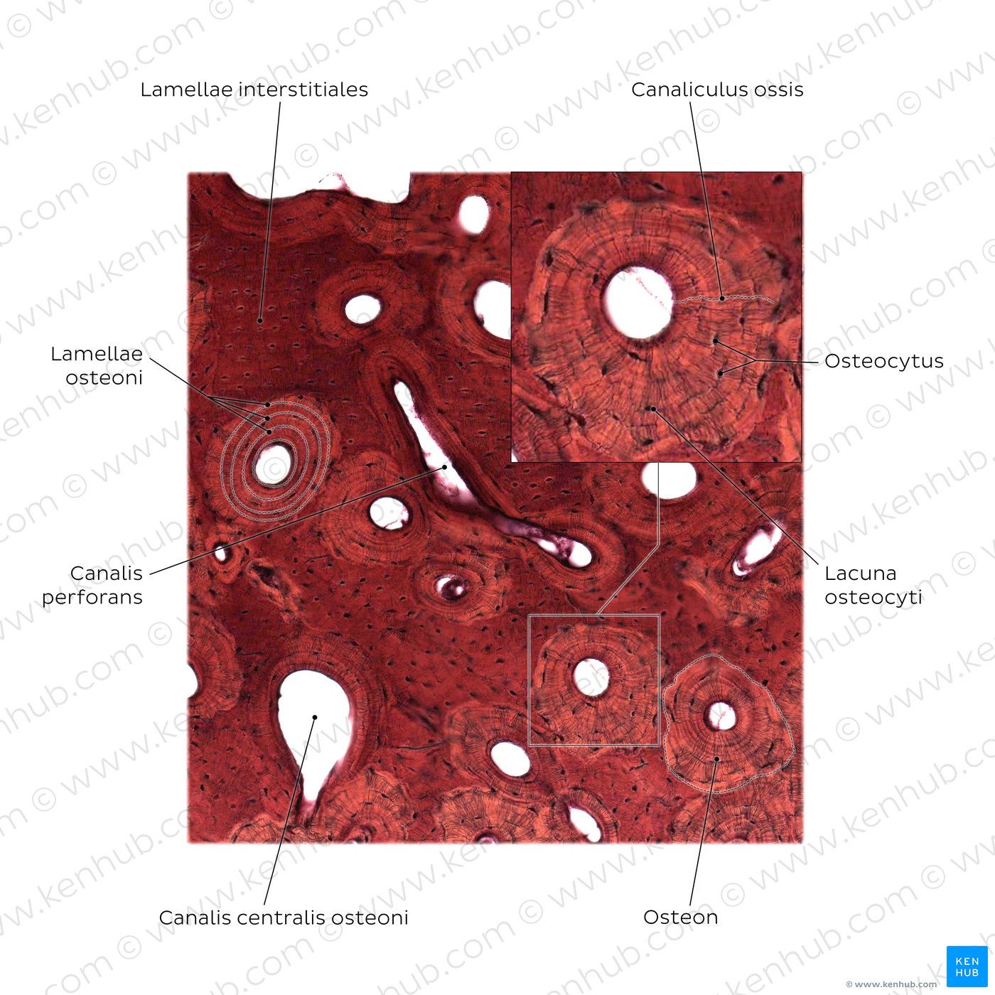 Compact bone. Stain: silver stain. Medium magnification