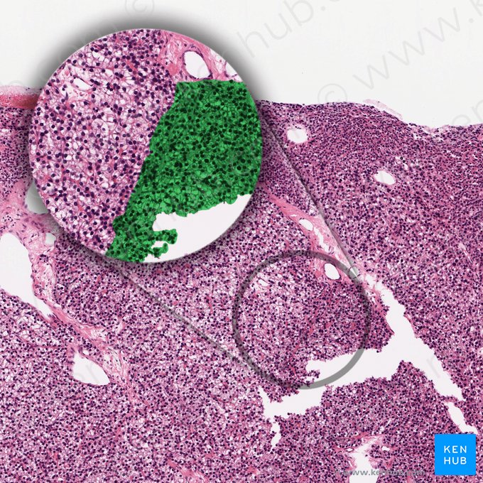 Parathyrocytus endocrinus densus (Dunkle Hauptzellen); Bild: 