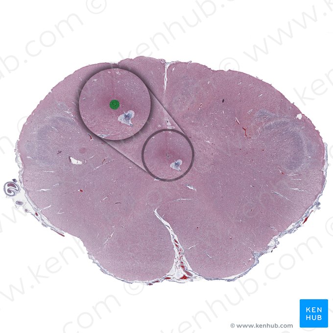 Central canal of the medulla oblongata; Image: 
