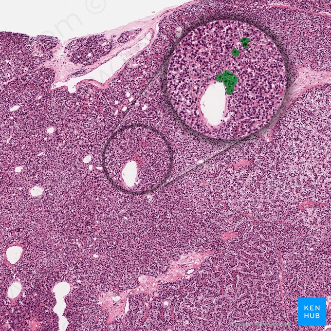 Parathyroid oxyphil cell (Parathyrocytus oxyphilicus); Image: 