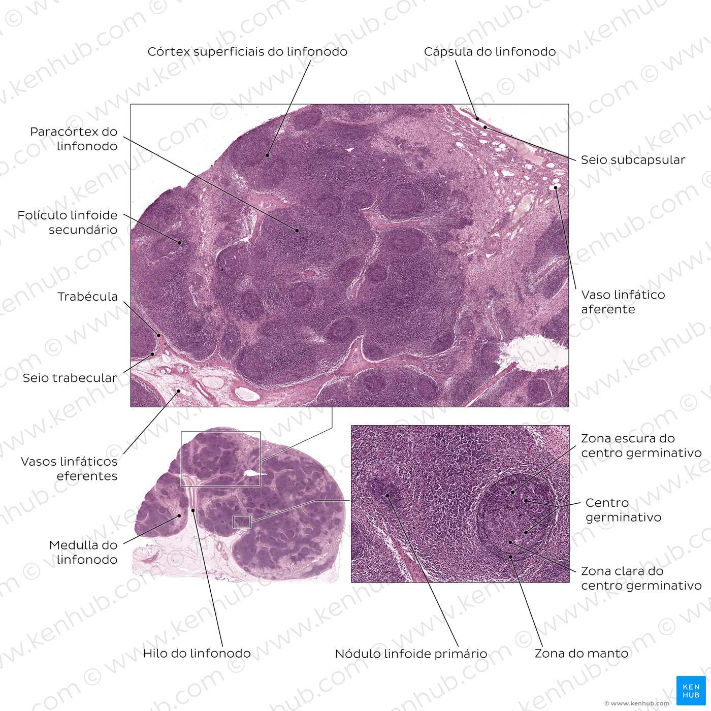 Active lymph node. Stain: hematoxylin and eosin. Medium magnification.