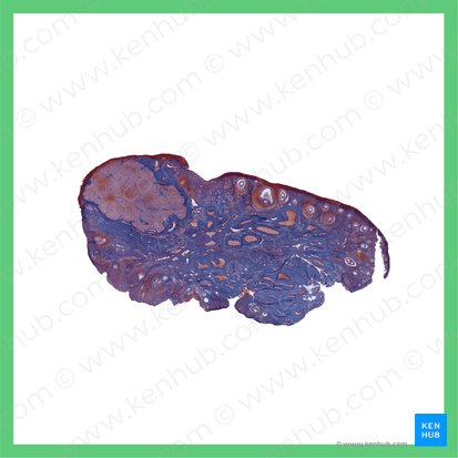 Ovarium (phasis secretoria) (Eierstock (Lutealphase)); Bild: 
