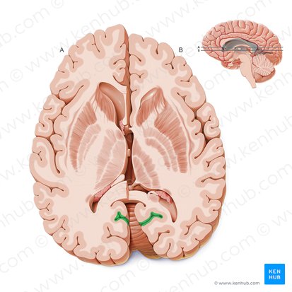 Sulcus calcarinus (Sehrindenfurche); Bild: Paul Kim